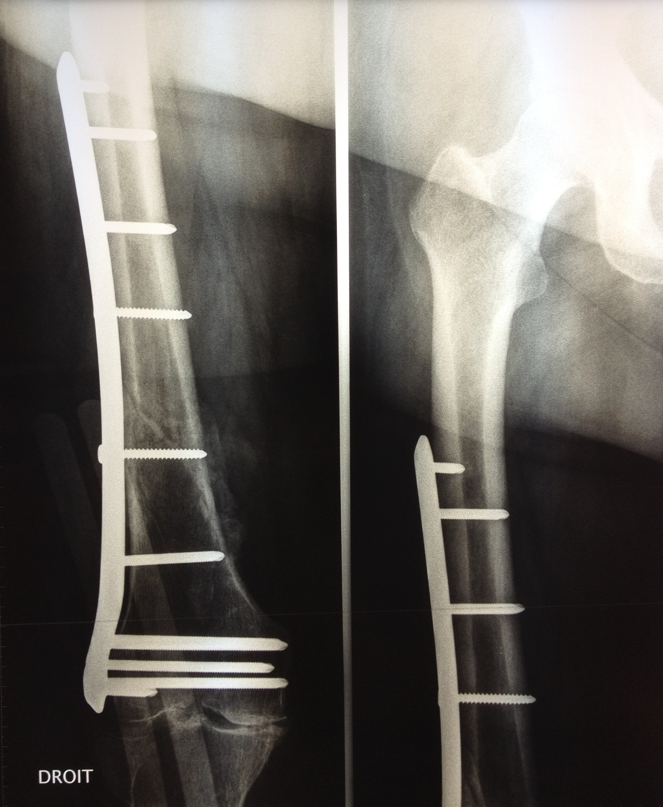 Chirurgie traumatologique Dr LEFEBVRE Benjamin