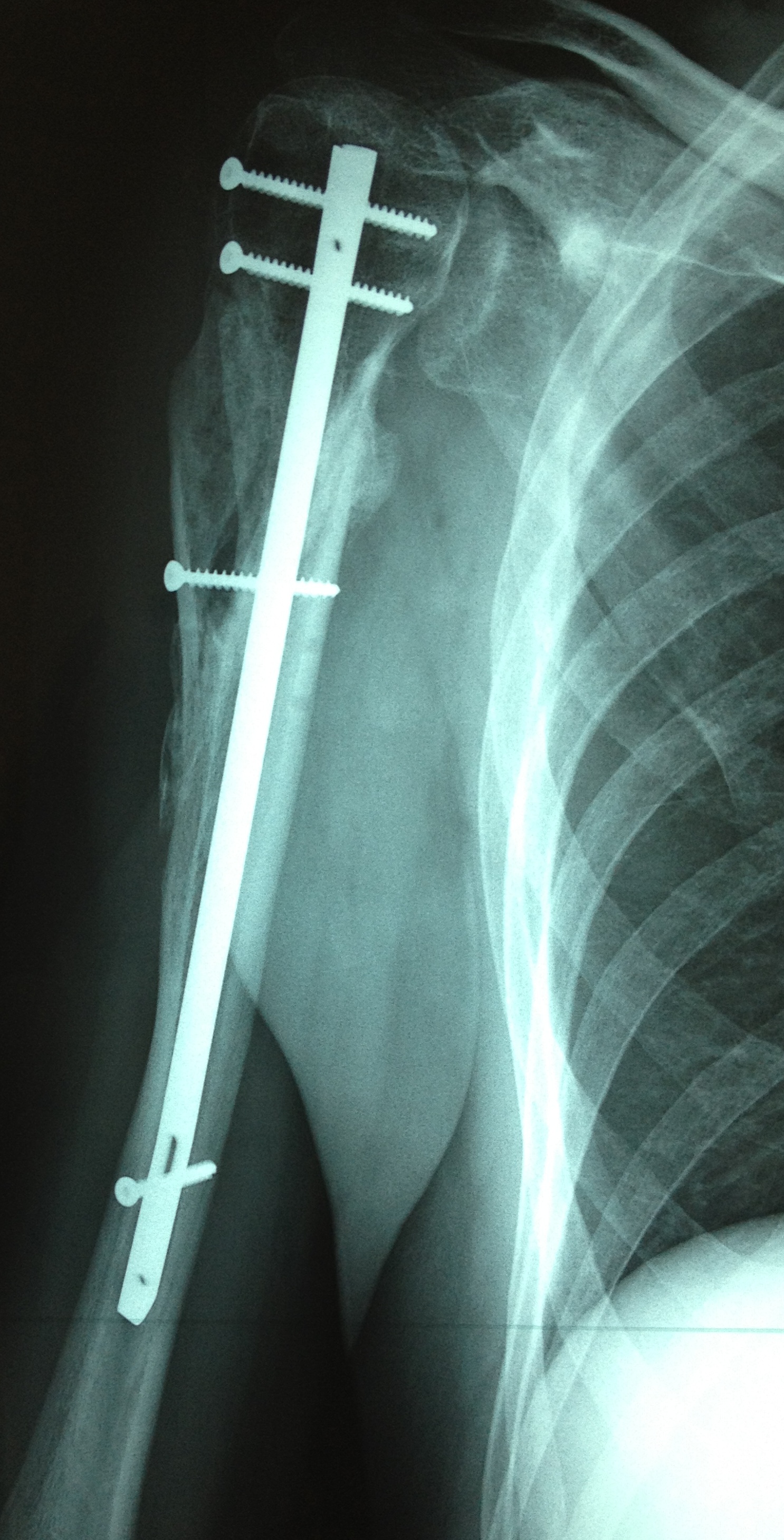 Chirurgie traumatologique Dr LEFEBVRE Benjamin