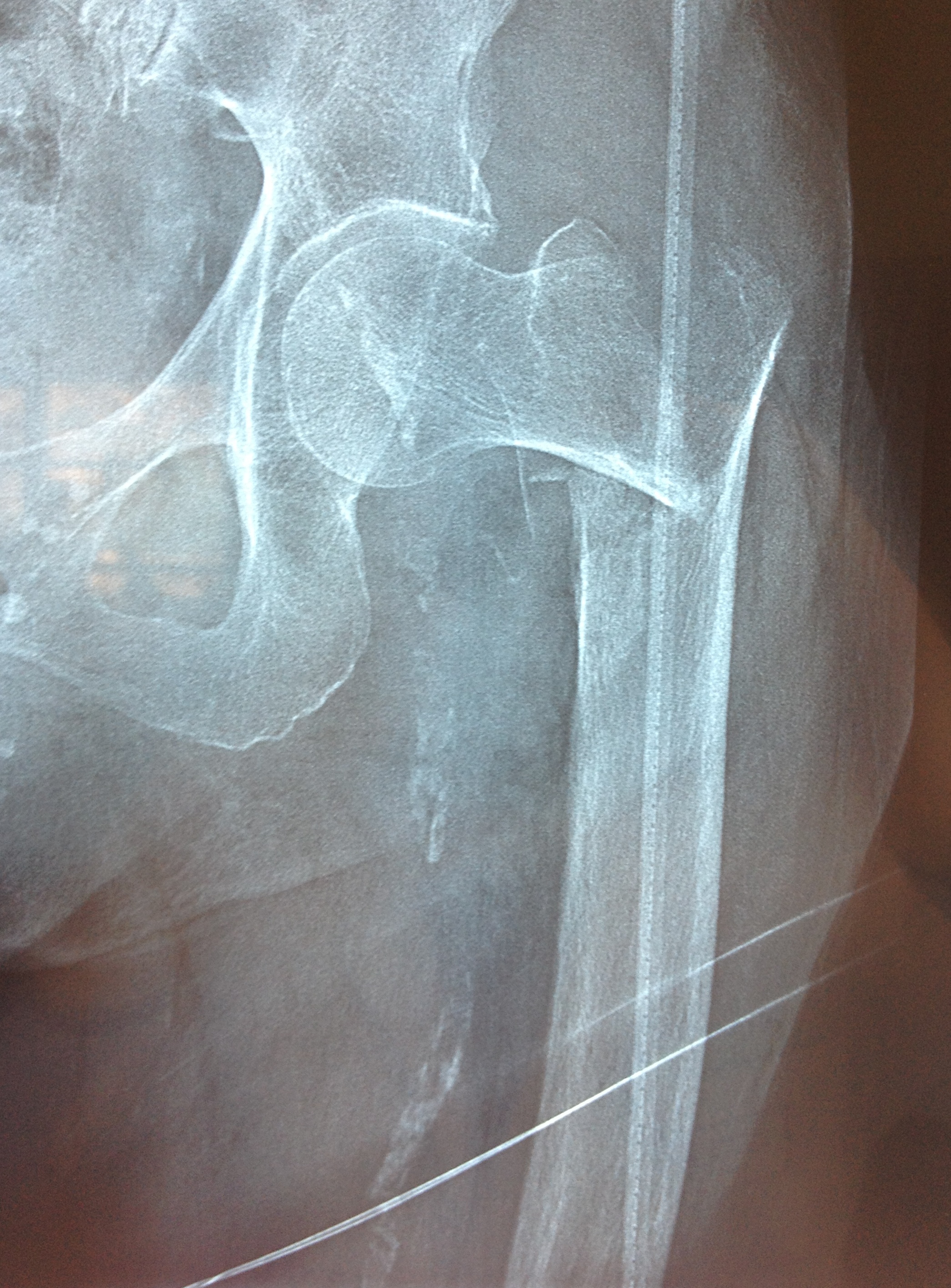 Chirurgie traumatologique Dr LEFEBVRE Benjamin