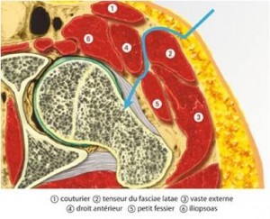 voie abord hanche